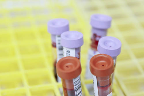 Whittington Health in Covid-19 Antibody Study